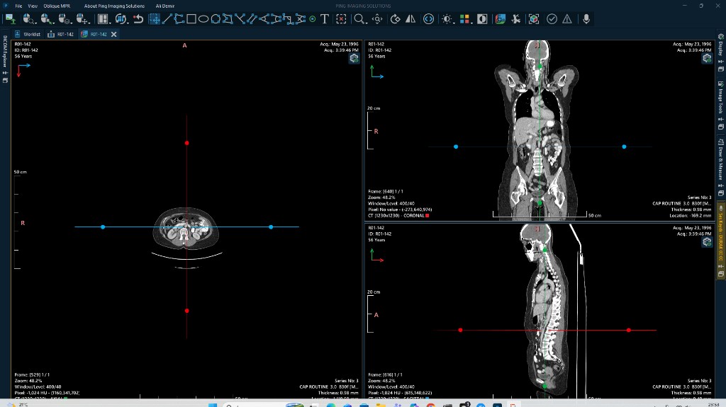 PING DICOM Workstation MPR and voice recording