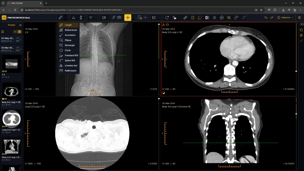 PING DICOM web viewer
