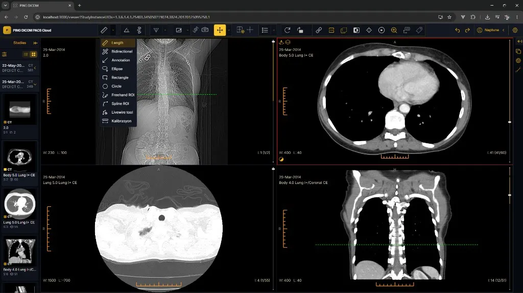 Web DICOM Viewer